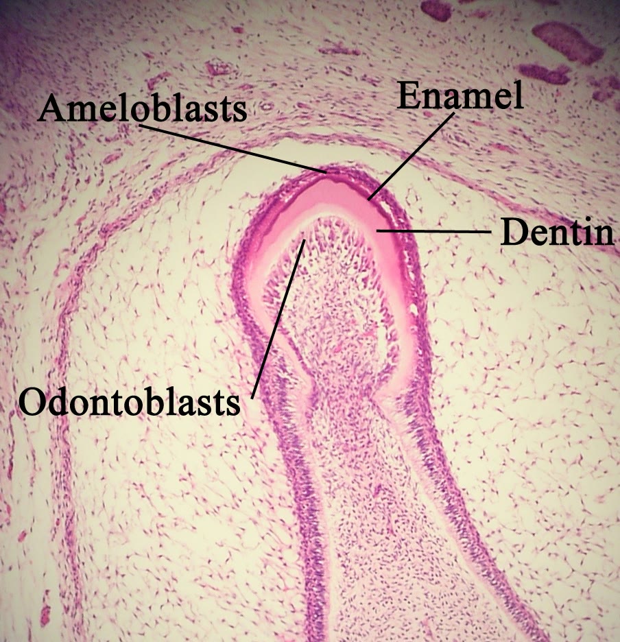 Corte microscópico de um germe dentário em formação, com ameloblastos, esmalte, dentina e odontoblastos indicados