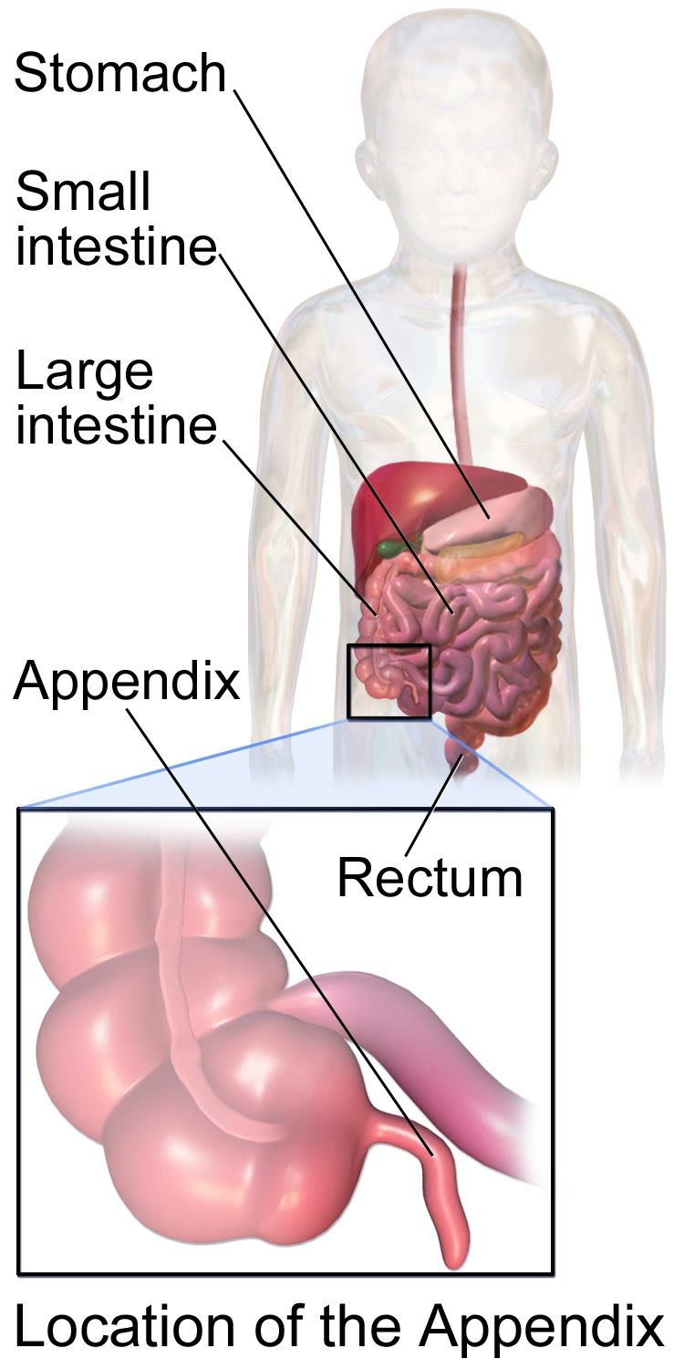 Ilustração anatômica: Apêndice vermiforme (Appendix)