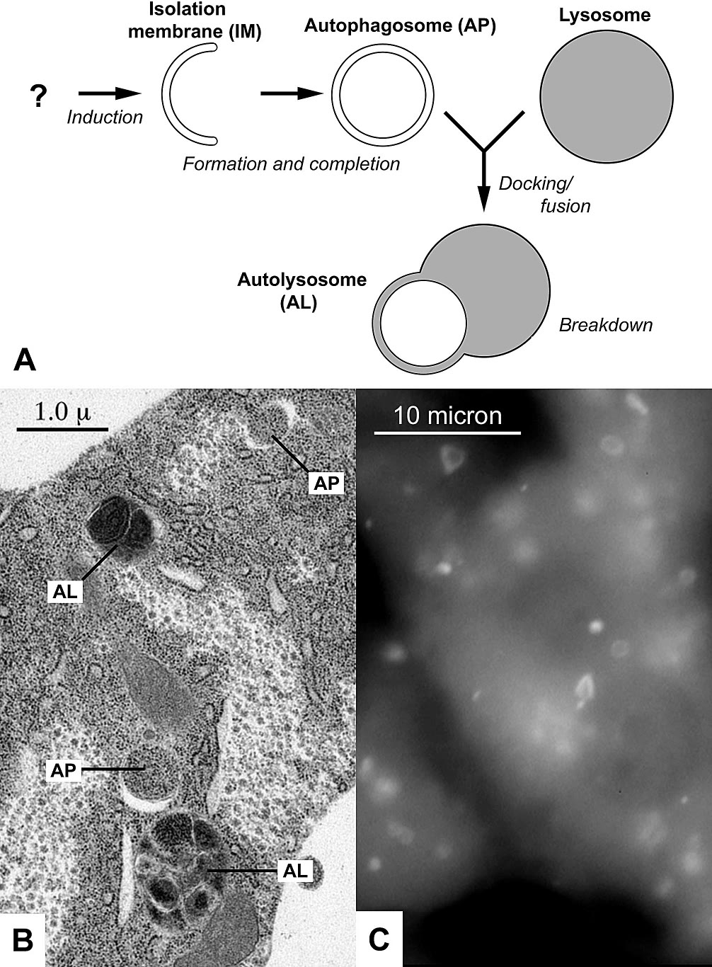 Ilustração anatômica: Autofagossomo (Autophagosomes)