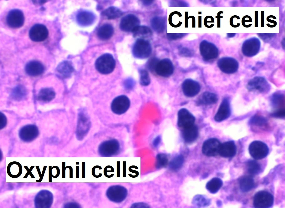 Ilustração anatômica: Célula oxífila (Oxyphil Cells)