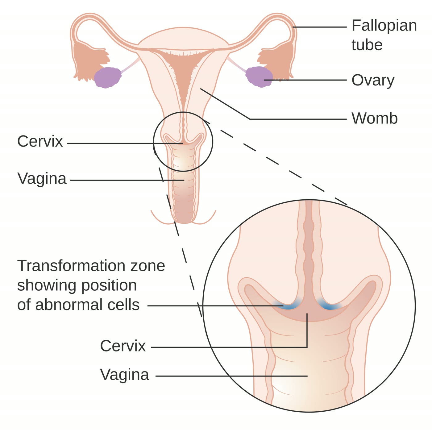 Ilustração anatômica: Colo do útero (Cervix)