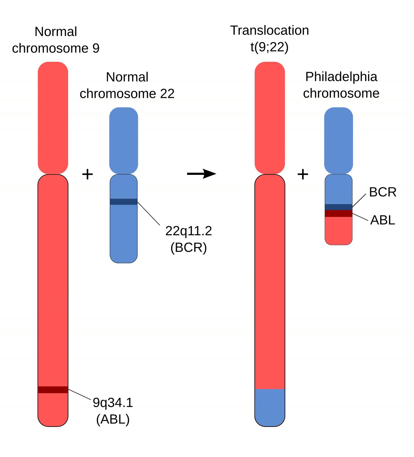 Ilustração anatômica: Cromossomo Filadélfia (Philadelphia Chromosome)