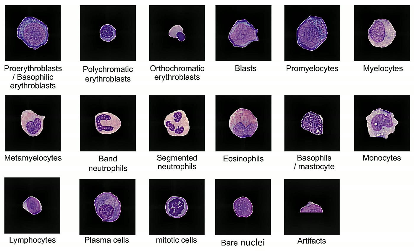 Ilustração anatômica: Eritroblasto (Erythroblasts)