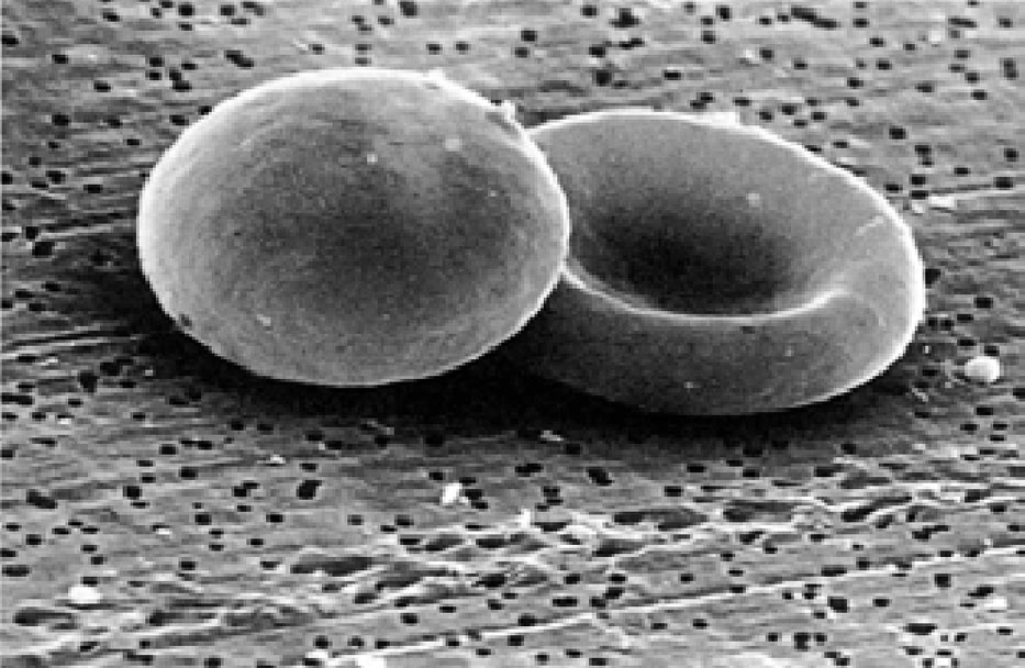 Ilustração anatômica: Esferócito (Spherocytes)
