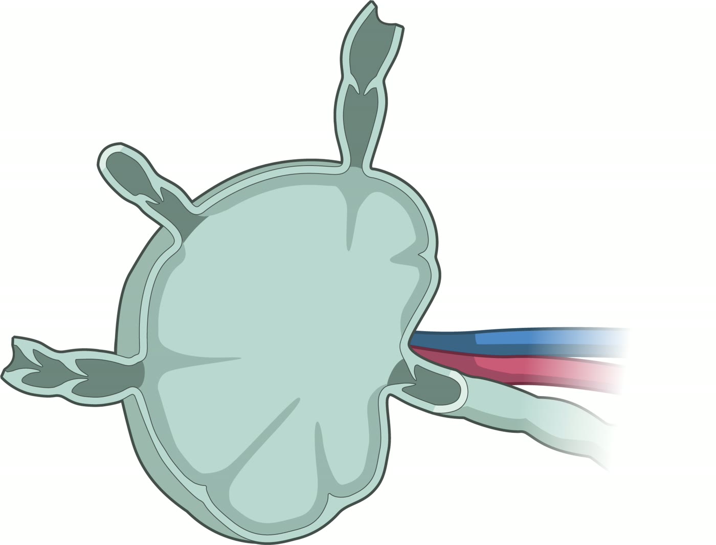 Ilustração anatômica: Linfonodo sentinela (Sentinel Lymph Node)