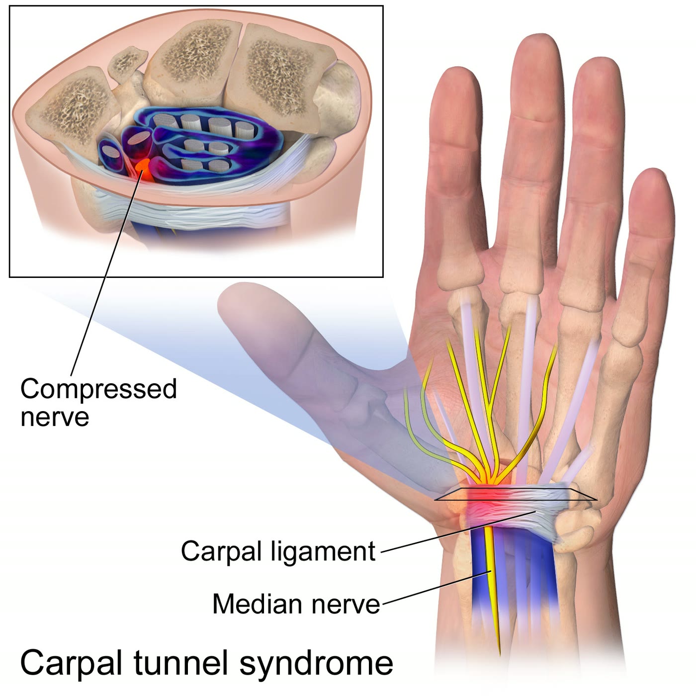 Ilustração anatômica: Nervo mediano (Median Nerve)