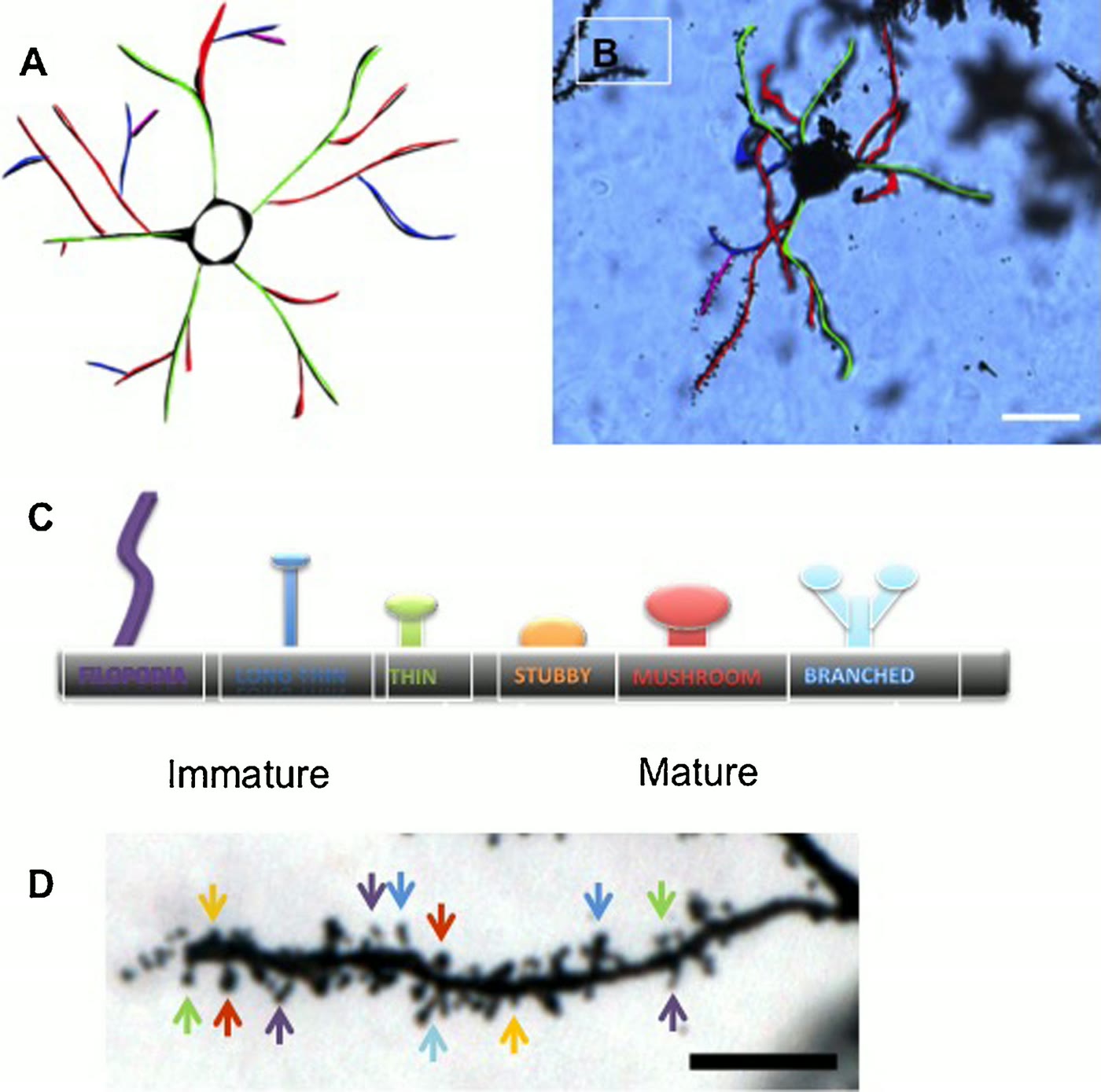 Ilustração anatômica: Neurônio espinhoso médio (Medium Spiny Neurons)