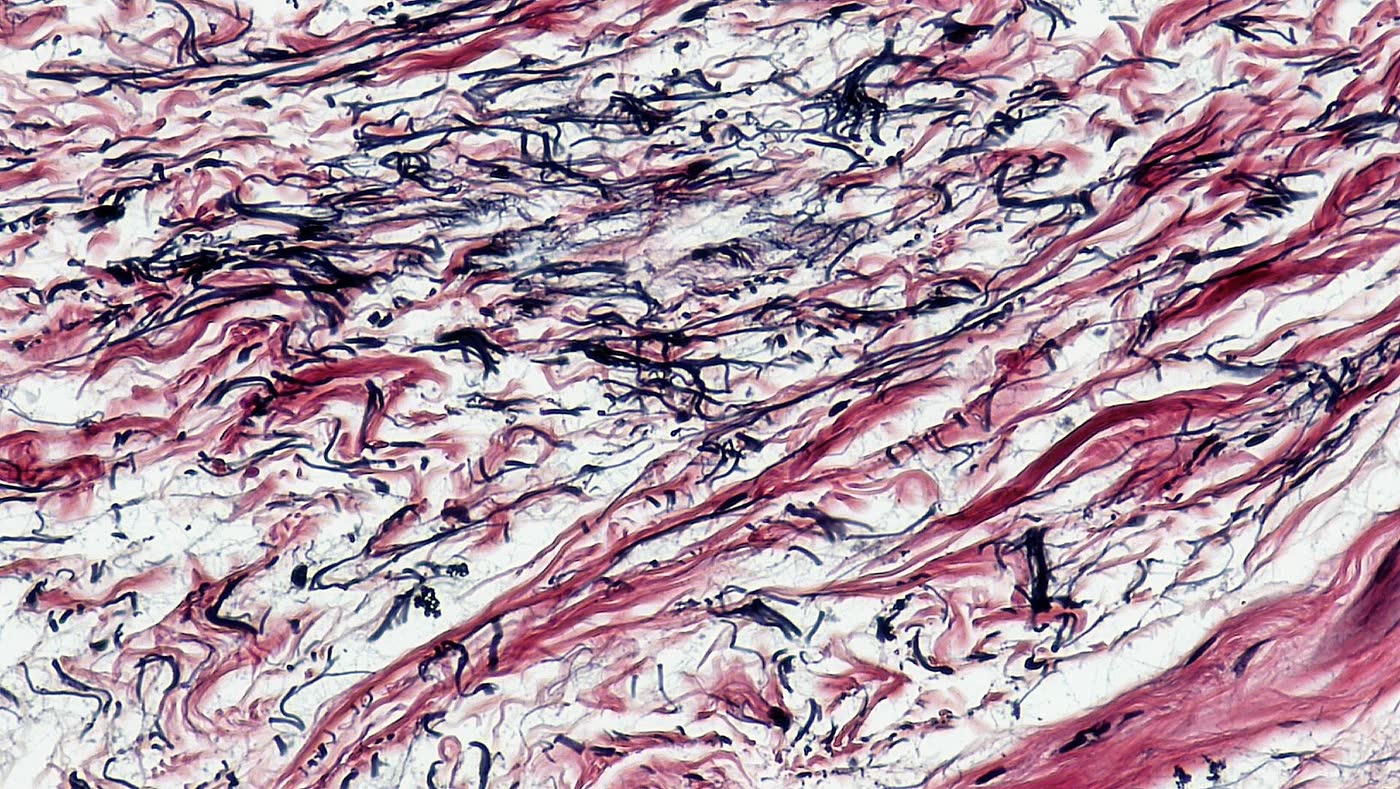 Ilustração anatômica: Tecido elástico (Elastic Tissue)